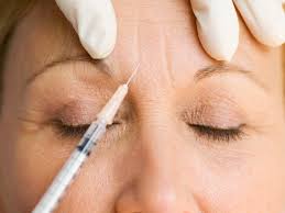 Botox for wrinkle prevention